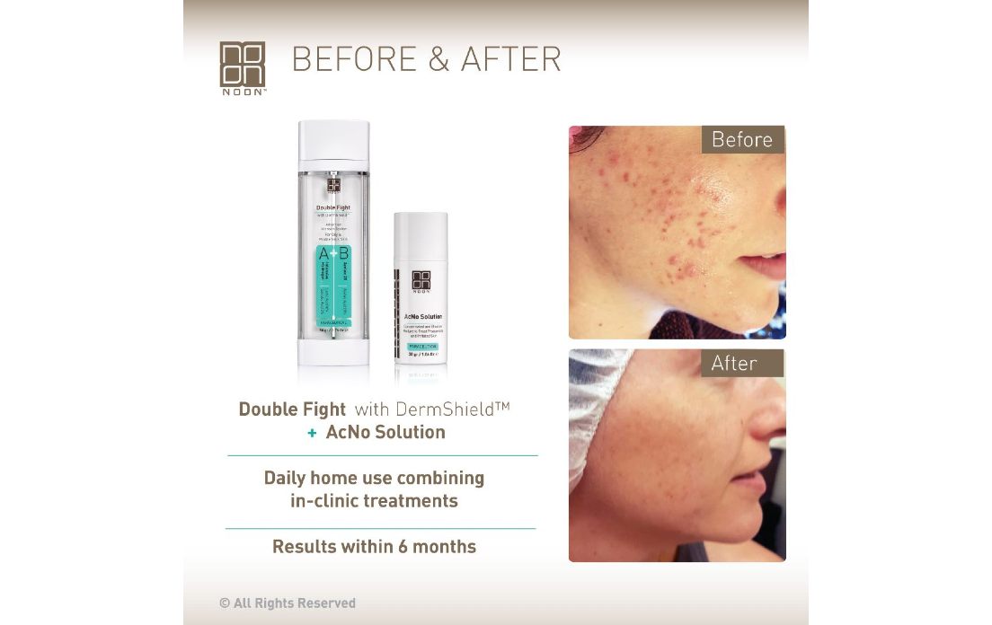 Препараты: Double Fight with DermShield + AcNo Solution